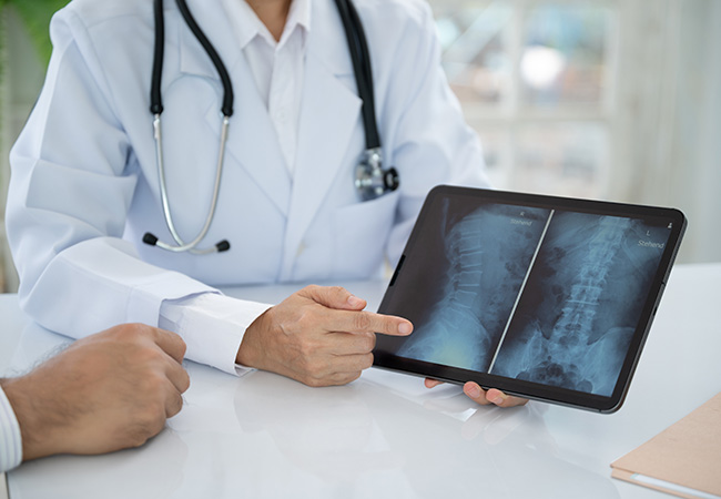 CT検査について